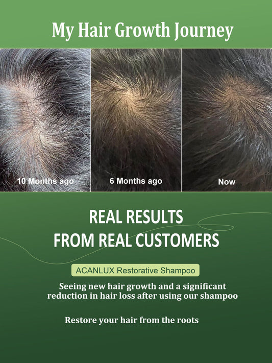 Real Results: See My Hair Growth Journey!