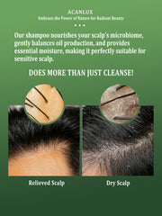 ACANLUX natural ingredient shampoo for dry scalp vs relieved scalp
